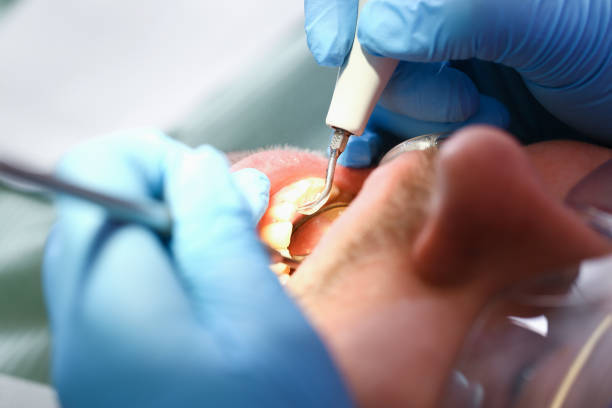 Best Mobile Emergency Dentist in Aloha, OR
