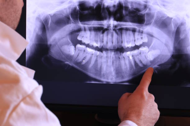 Best Emergency Dentist for Knocked-Out Tooth in Aloha, OR