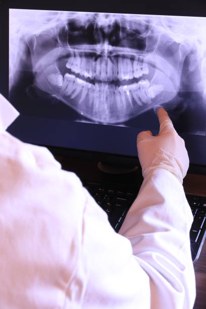 Best Emergency Dental Extractions in Aloha, OR
