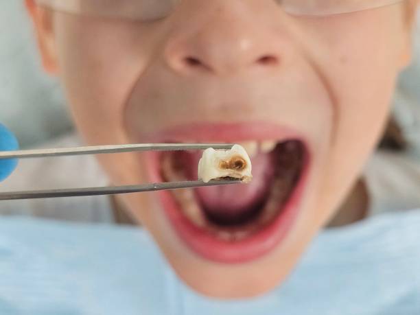 Best Pediatric Emergency Dentist in Aloha, OR